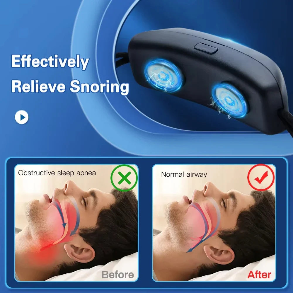 Stop Snore Portable USB Anti Snoring Device Sleep Apnea Aid