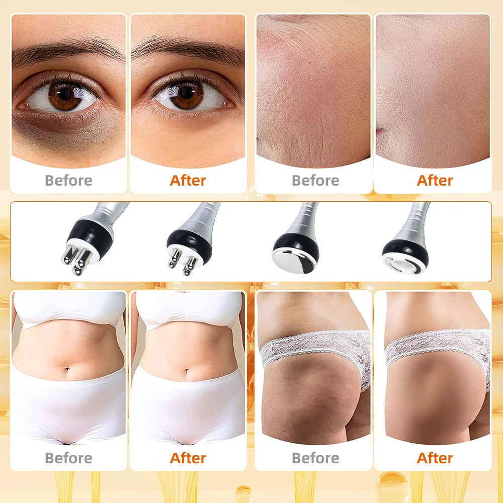 Ultrasonic Cavitation Body Slimming Machine Facial Massager